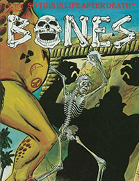 Bones